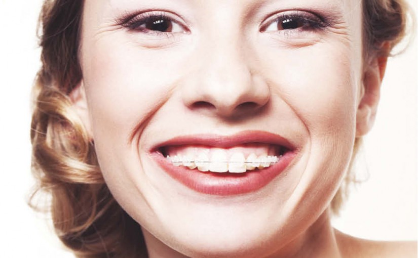 7 rzeczy, które musisz wiedzieć, zanim wybierzesz ortodontę