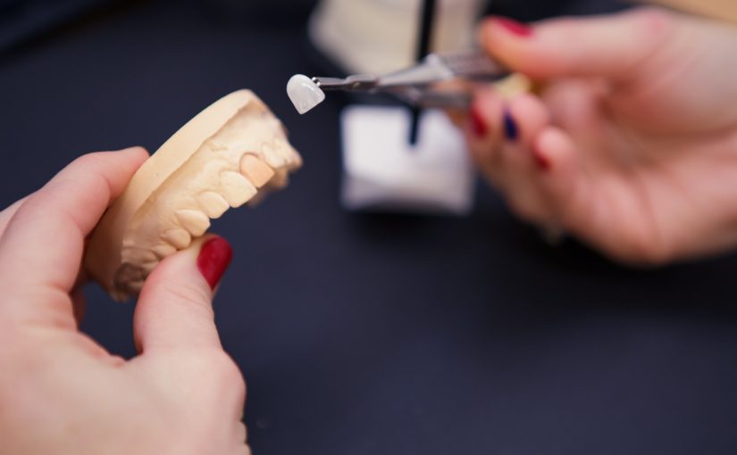 2014 - wprowadzamy do swojej oferty autorskie licówki Softveeners, które nie wymagają szlifowania zębów